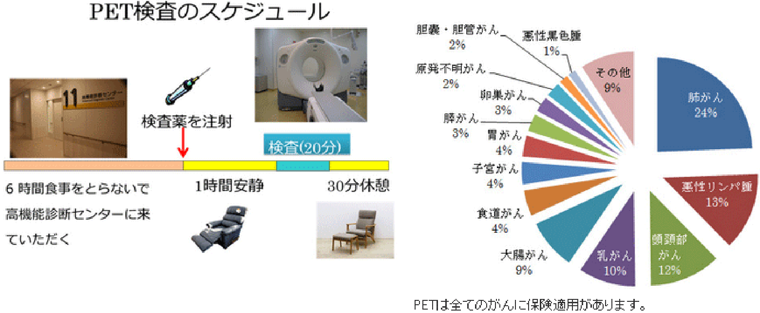 PETの特徴と検査方法