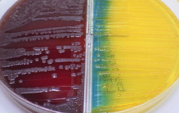 培地に発育した大腸菌