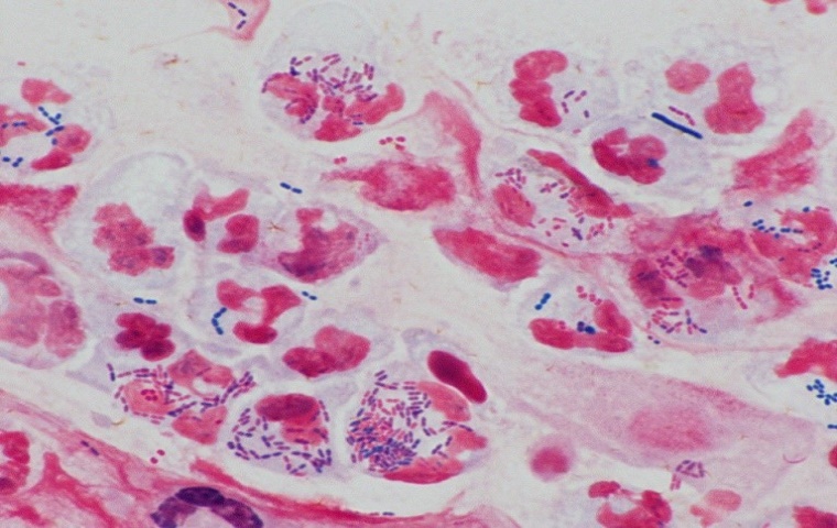 顕微鏡で見た貪食された細菌